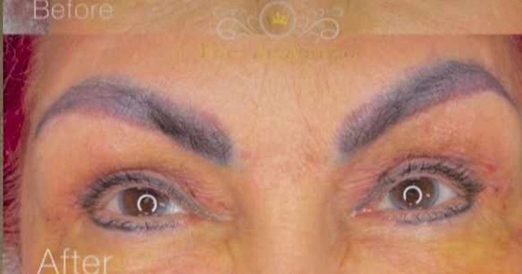 Elena Merișoreanu resorted to a beautification procedure: "There was nothing painful"