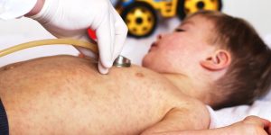 “It’s a ticking time bomb.” Romania at the top of the EU ranking in the number of measles cases, amid the collapse of vaccination rates