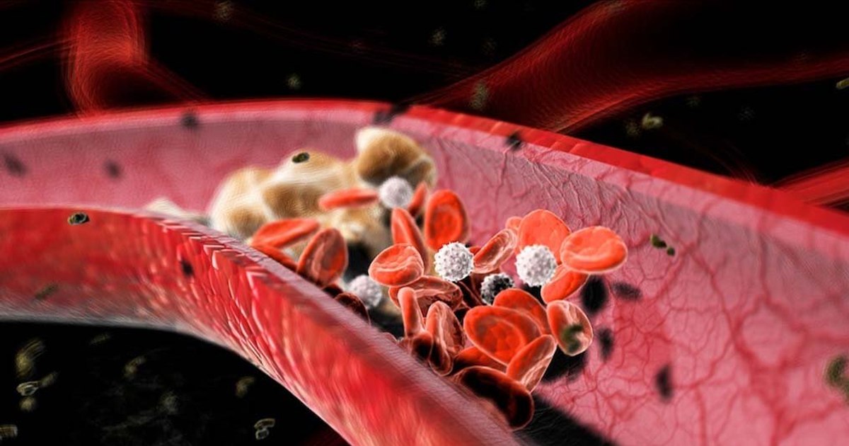 Cholesterol, necessary for the body.  How to keep the balance between "good" and "bad", advice from a nutritionist