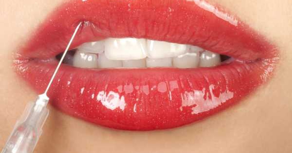 Snapchat Dysmorphia: People have gotten plastic surgery to look like their filtered photos