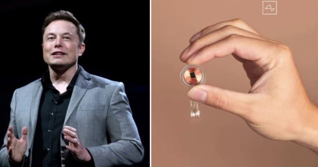 Why we should be skeptical of Elon Musk's claims about the first Neuralink implant