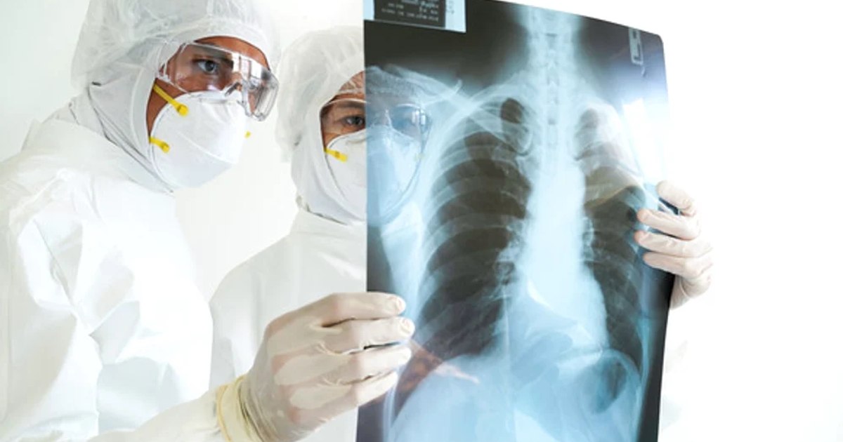 Alarm signal: The number of young people with cancer has increased sharply