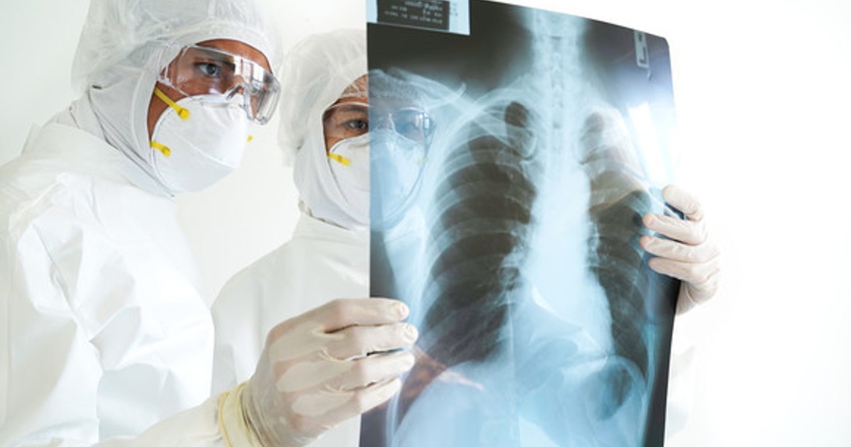 Radon, the invisible killer from Transylvania.  Doctor: "It attaches to the aerosol and stays at the level of 1-1.5 m high, exactly where children breathe"