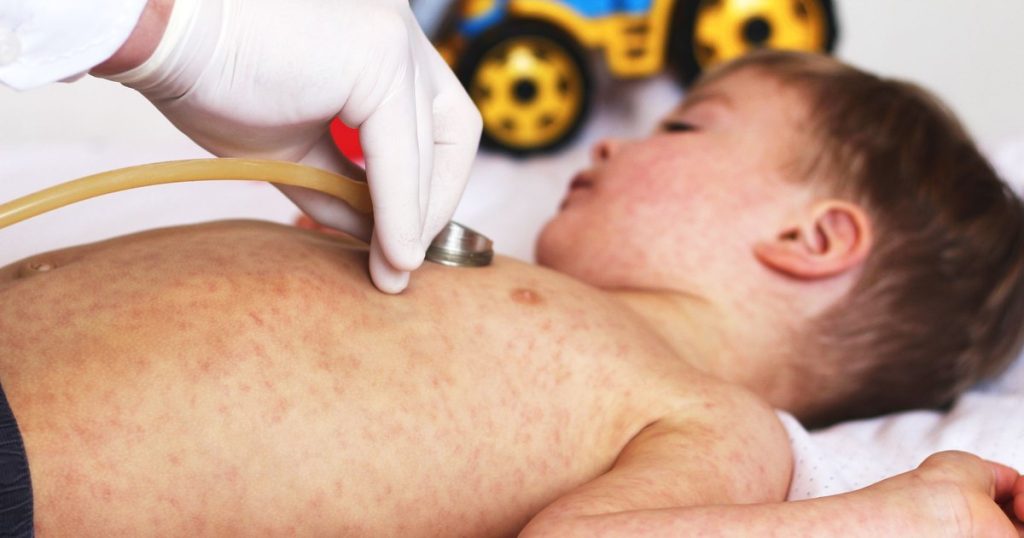 A pediatrician's warning: "Diseases that frequently killed children in the past will return"