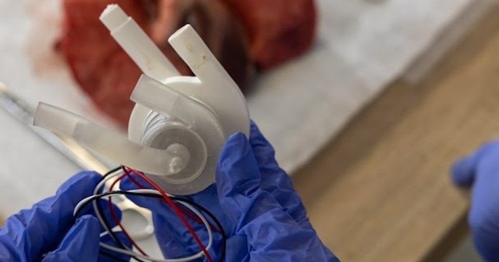 Artificial heart that lasts 100 years will have a phone app: 'Patients can see the volume of blood being pumped'