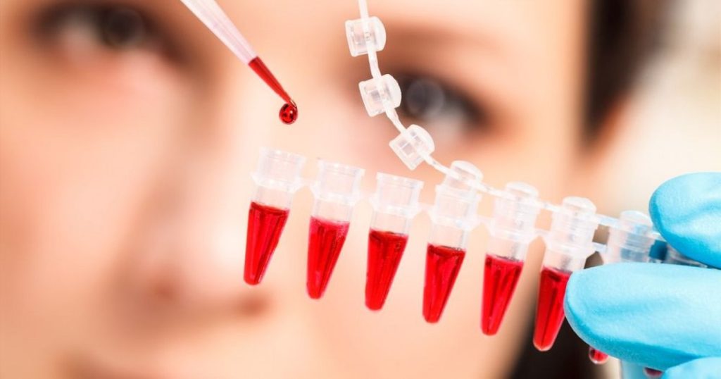 Blood test that predicts risk of breast cancer recurrence 3 years ahead.  It's an 'incredibly exciting' discovery