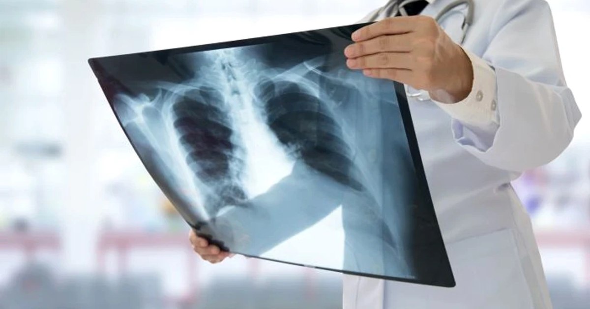 Which generations are more prone to cancer compared to parents and grandparents.  Doctor, about the advantages in the fight against the disease