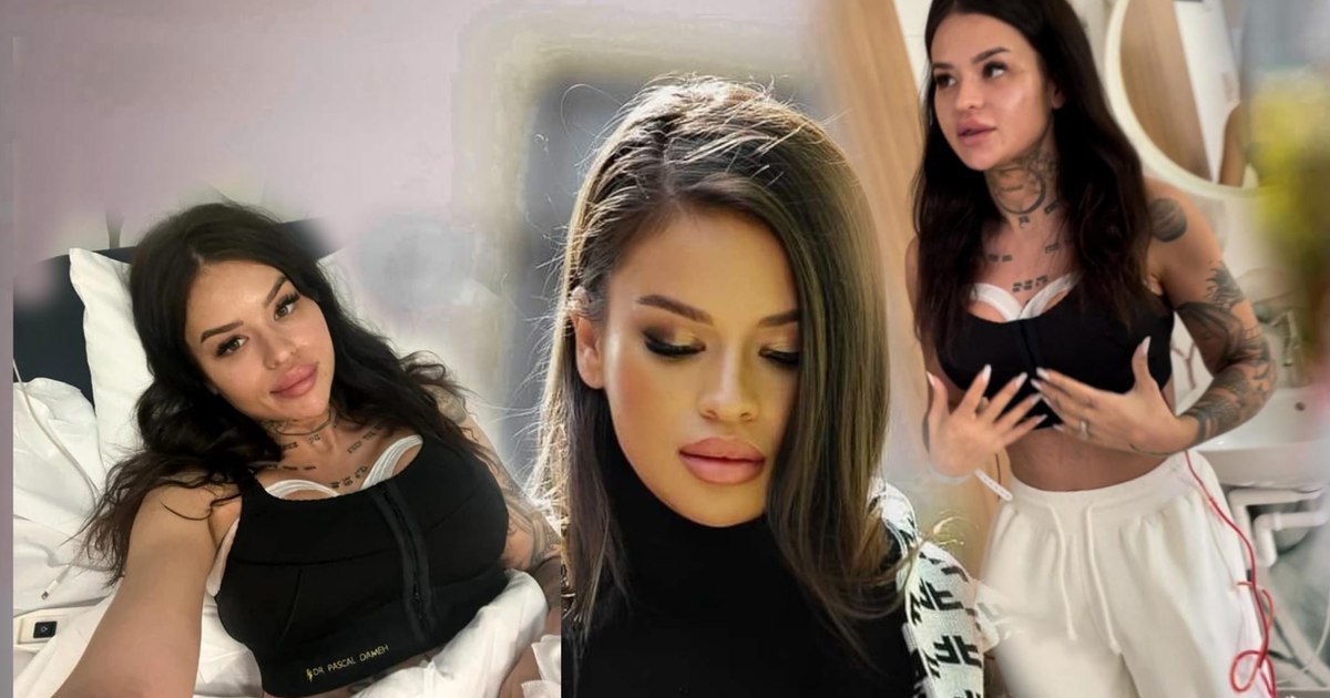 Diandra Moga, the former temptation from Love Island, underwent a second aesthetic intervention. "I've wanted this since the first surgery"