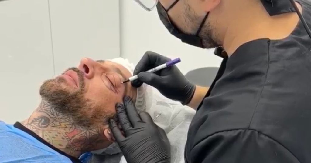 Video What CRBL looks like after the cosmetic surgery he resorted to: "I hope the recovery is easy"
