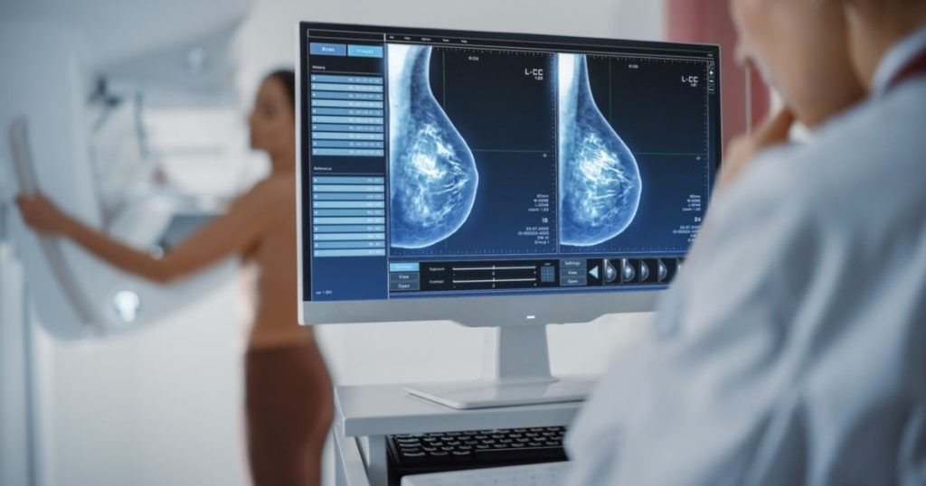 Excess body fat, a significant factor in the risk of breast cancer