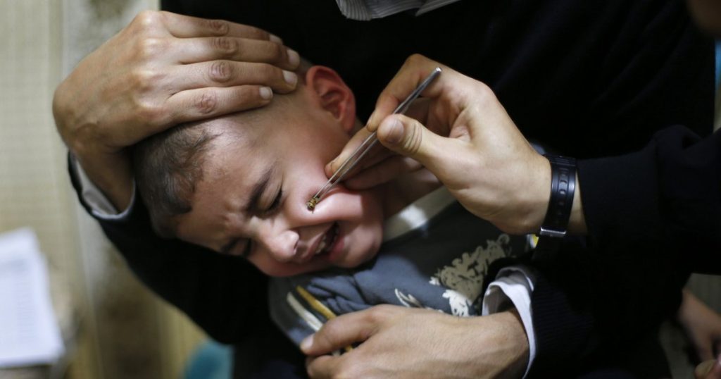 The devastating complications of sinusitis in children. Why is it worse than in an adult?