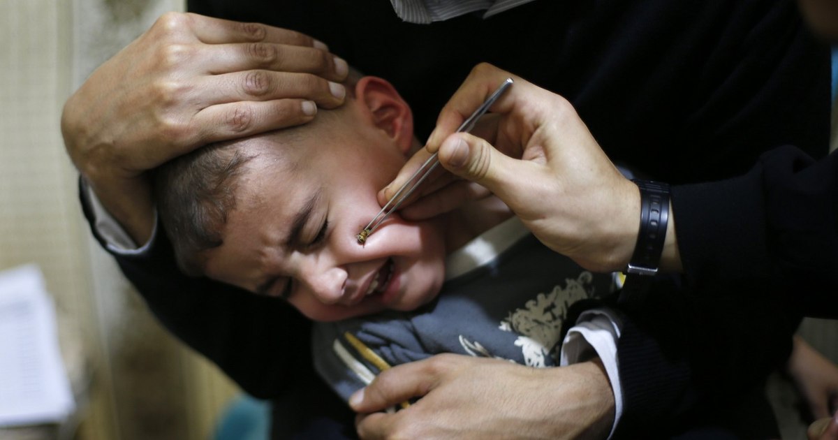 The devastating complications of sinusitis in children. Why is it worse than in an adult?