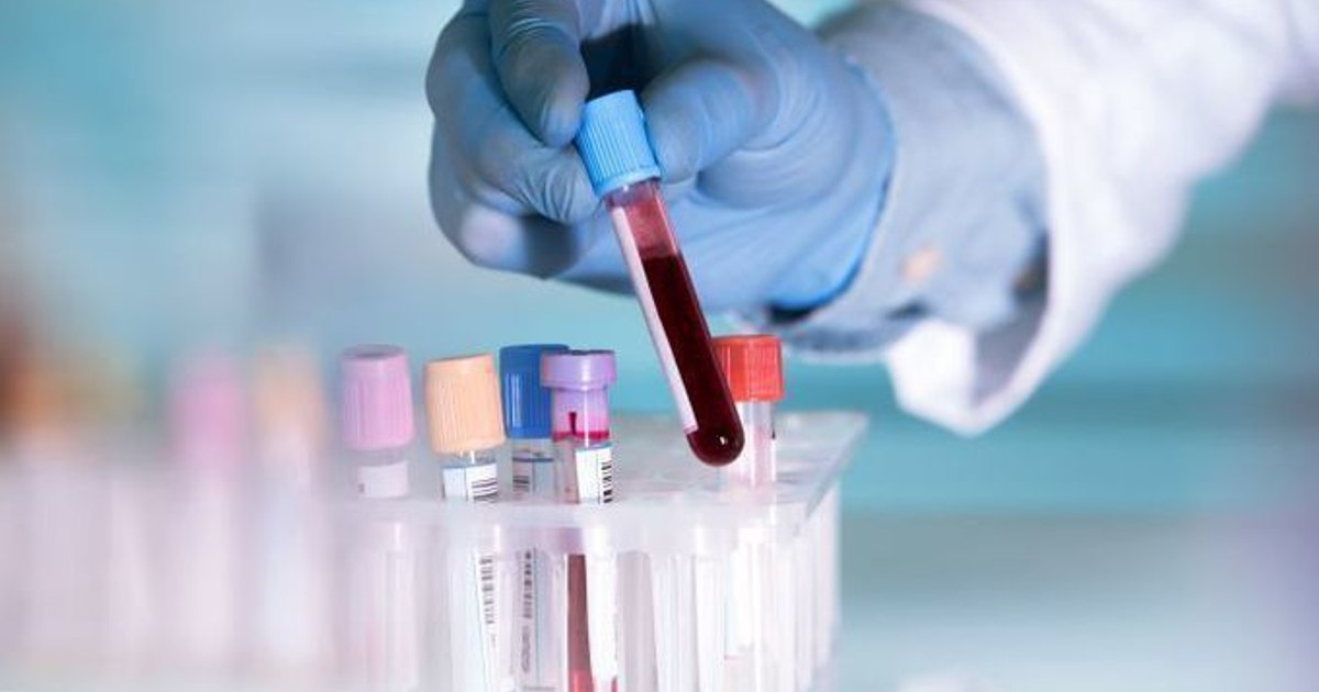 Blood tests that enable early detection of several types of cancer, developed by Oxford researchers