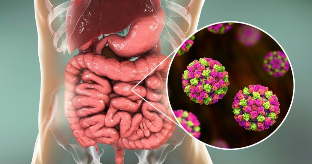 How to protect yourself from norovirus. The complete guide to hygiene and prevention