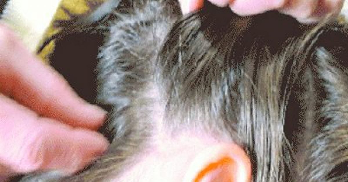 How we get rid of lice children. Natural treatments that really work