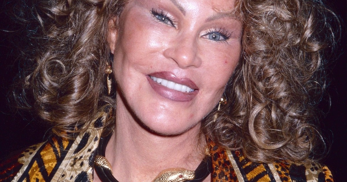 Jocelyn Wildenstein, nicknamed "Catwoman", has died. She was known for her extreme cosmetic surgeries