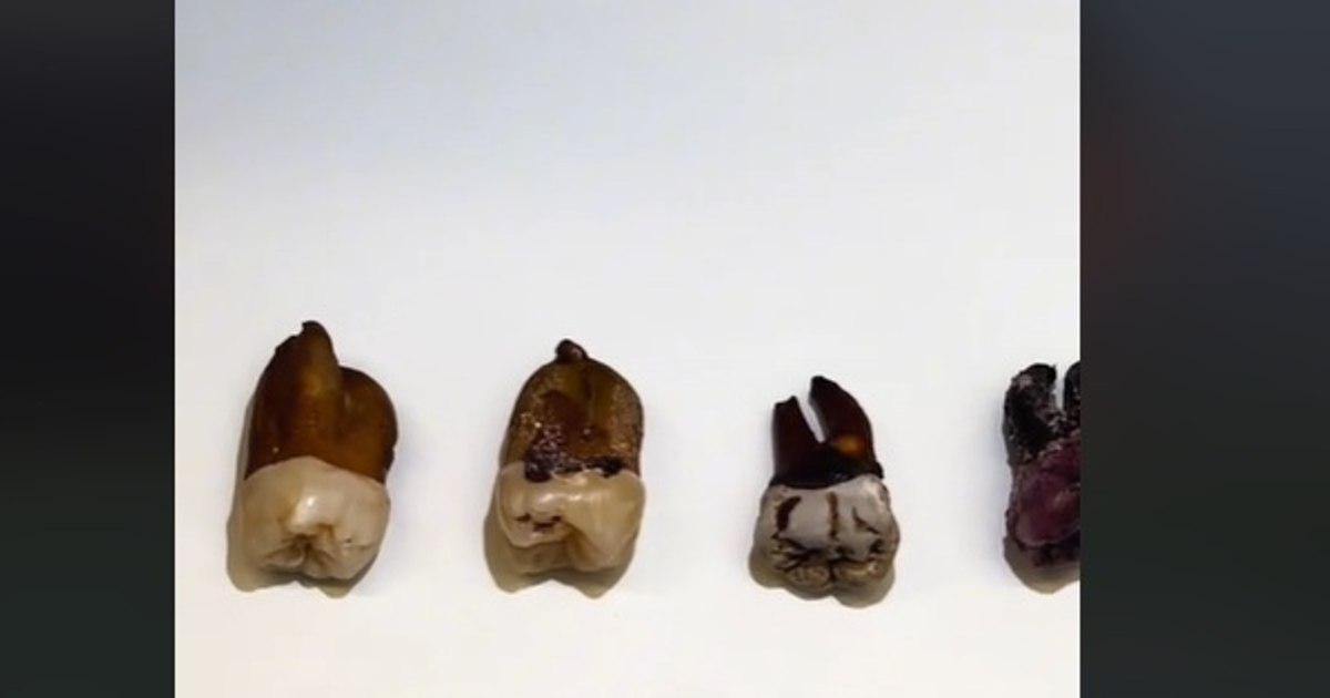 Video Which drink stains your teeth more: cola, tea, coffee or red wine. Unexpected results of the experiment