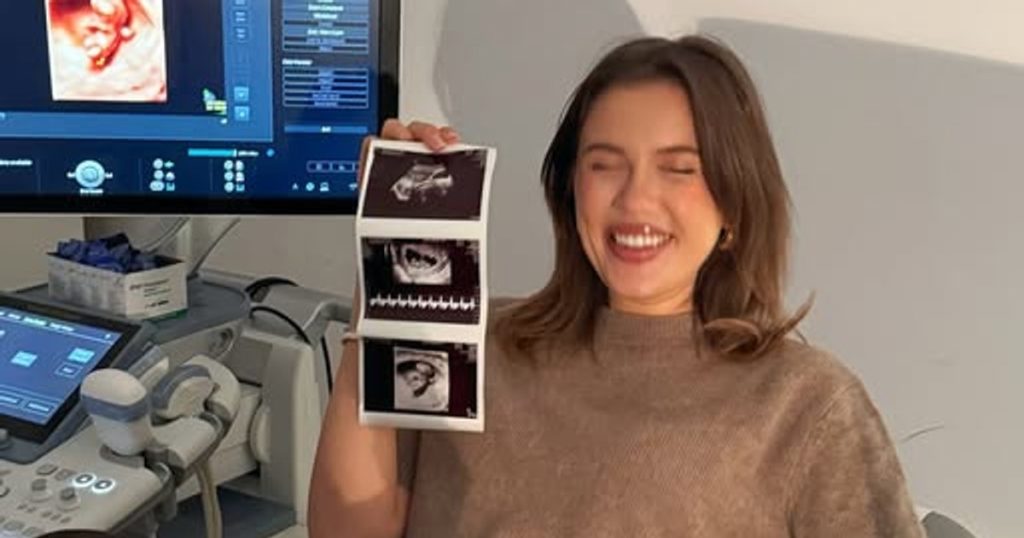 Emily Burghelea, pregnant for the third time. How he gave the fans the news