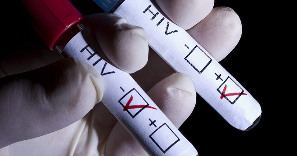 HIV infection is no longer a death sentence. Specialist: "Patients can live even more than people who are not infected"