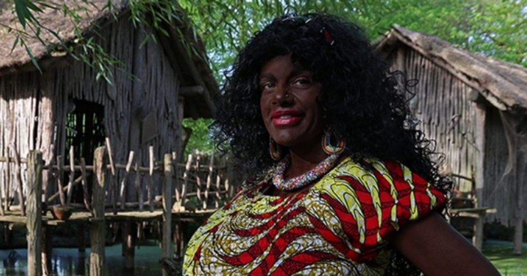 Photo The controlled control of a model that "identifies itself as black". Announced he was moving to Africa after making tanning injections