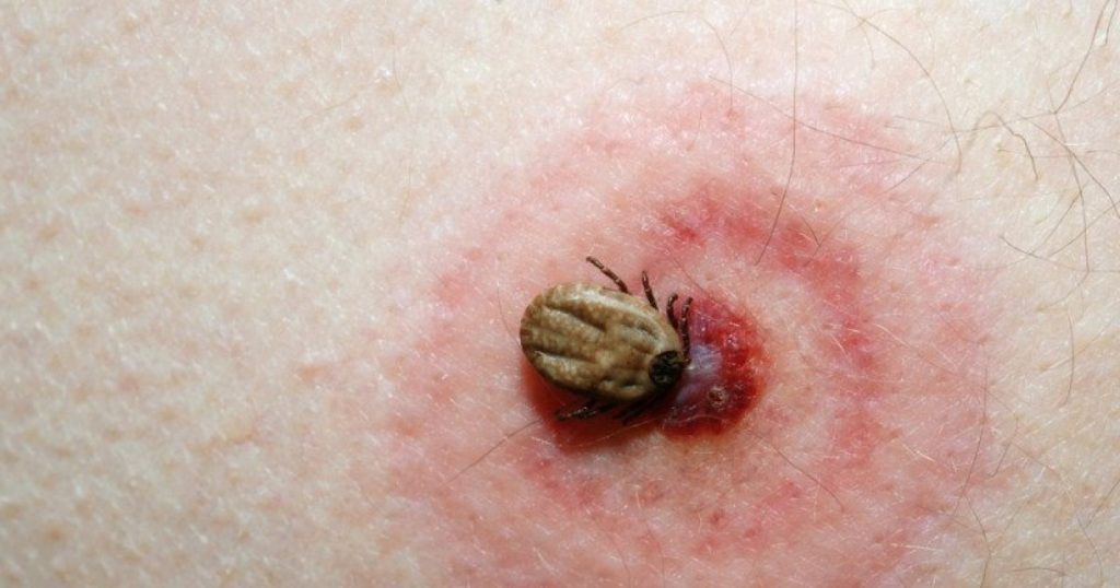 Attention to ticks. The warning of the doctor Ciuhodaru: "I can send you directly to neurology"