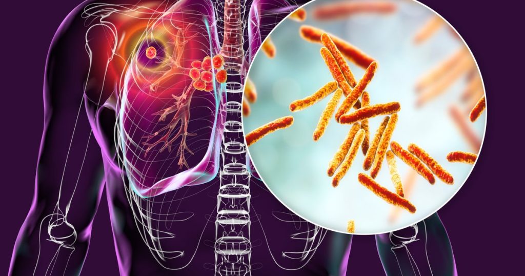 What Europe has to do to reduce the mortality caused by diseases such as HIV, TB, viral hepatitis and ITS. What is the situation in Romania