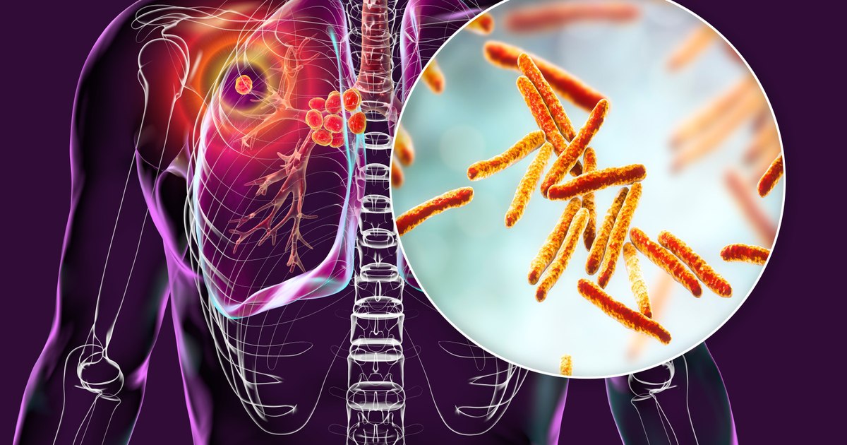 What Europe has to do to reduce the mortality caused by diseases such as HIV, TB, viral hepatitis and ITS. What is the situation in Romania