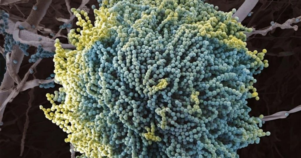 A killer fungus, similar to the one in the movie "The Last of Us", threatens humanity: "Reality is already quite frightening"