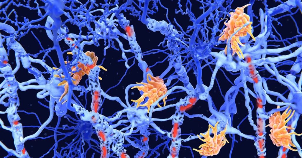 "Reverse vaccines": the revolutionary solution for autoimmune diseases and allergies. A new "holy gray" of medicine