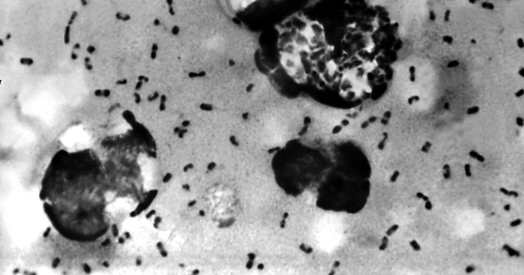 The mystery of "black death" was revealed by scientists. A single gene allowed to withstand over the centuries