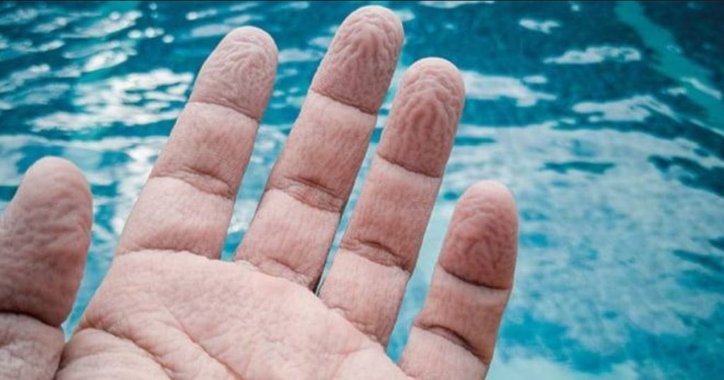 Why are the fingers wrinkled in the water always in the same way. The researchers made new discoveries