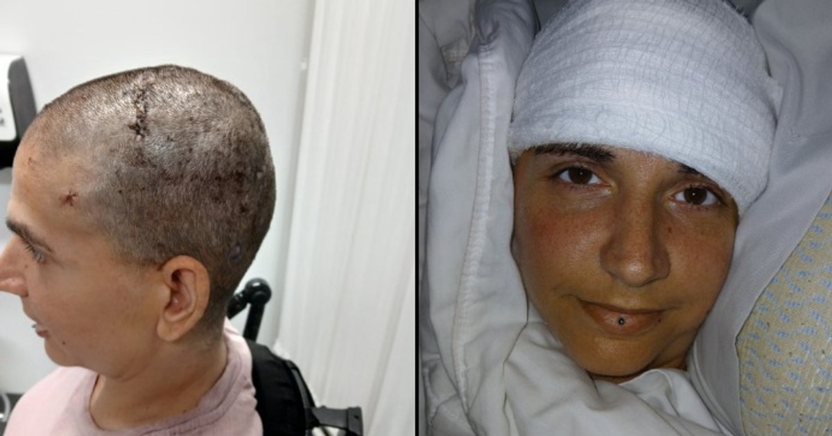 A paralyzed woman reveals what effect she had on the brain implant of Neuralink. "Controls its computer only by thinking"