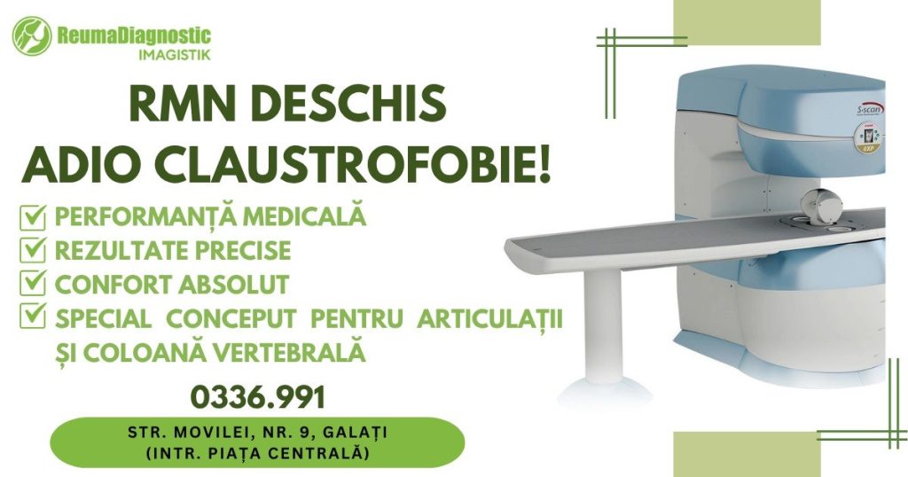 Open MRI dedicated to musculoskeletal disorders: precision and comfort in osteo-articular diagnosis