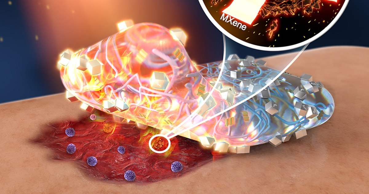 Plastics that heal the wounds with the help of the sun - without antibiotics