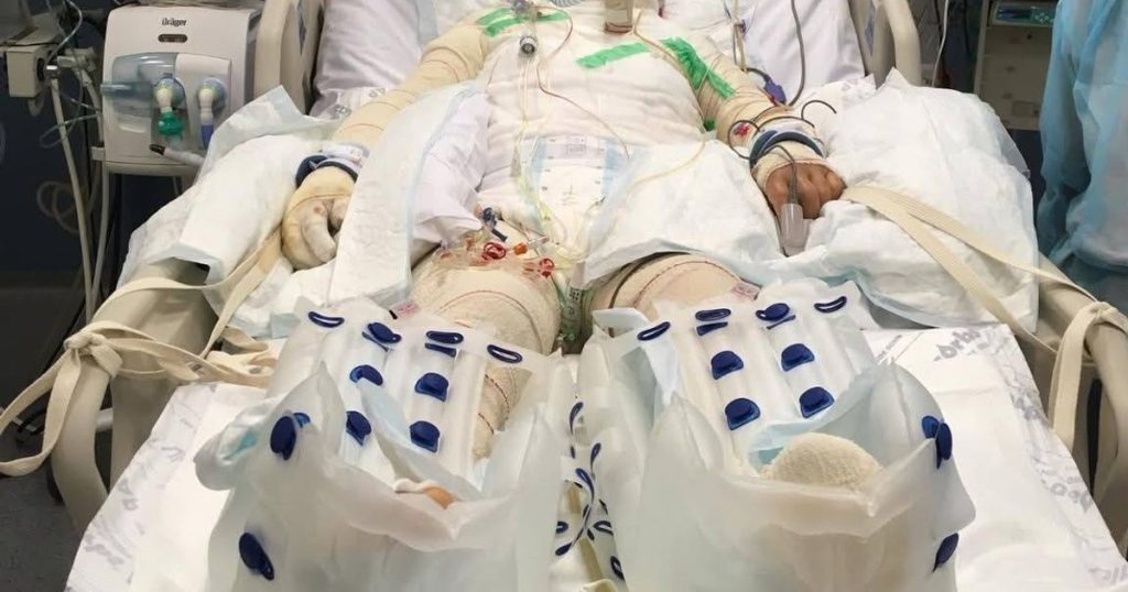 "I feel deeply endless and disturbed." The manager of Floreasca Hospital reacted to the charges made by the patient's sister infected with Candida Auris