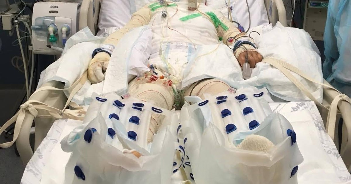 "I feel deeply endless and disturbed." The manager of Floreasca Hospital reacted to the charges made by the patient's sister infected with Candida Auris