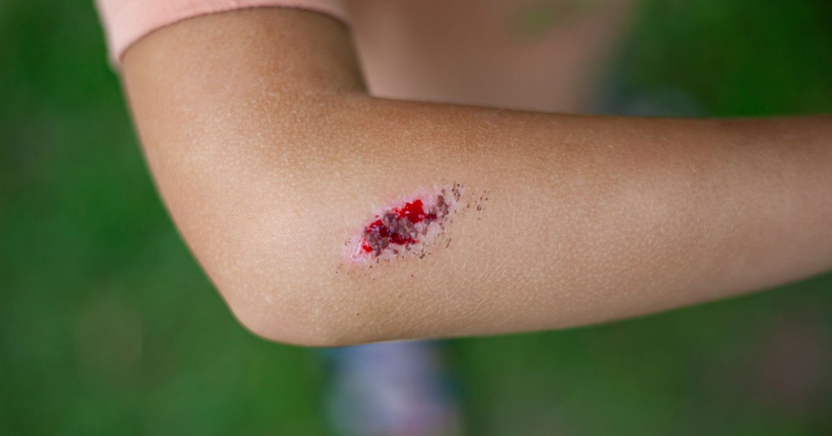 Serious infectious disease, with high mortality if not treated quickly and correctly. Spores that cause her can survive years