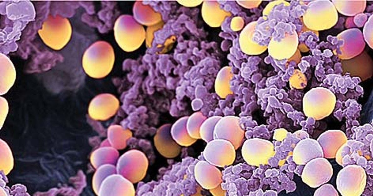 Doctors warn: not all microbes identified in children's nose, including golden staphylococcus, cause seasonal diseases