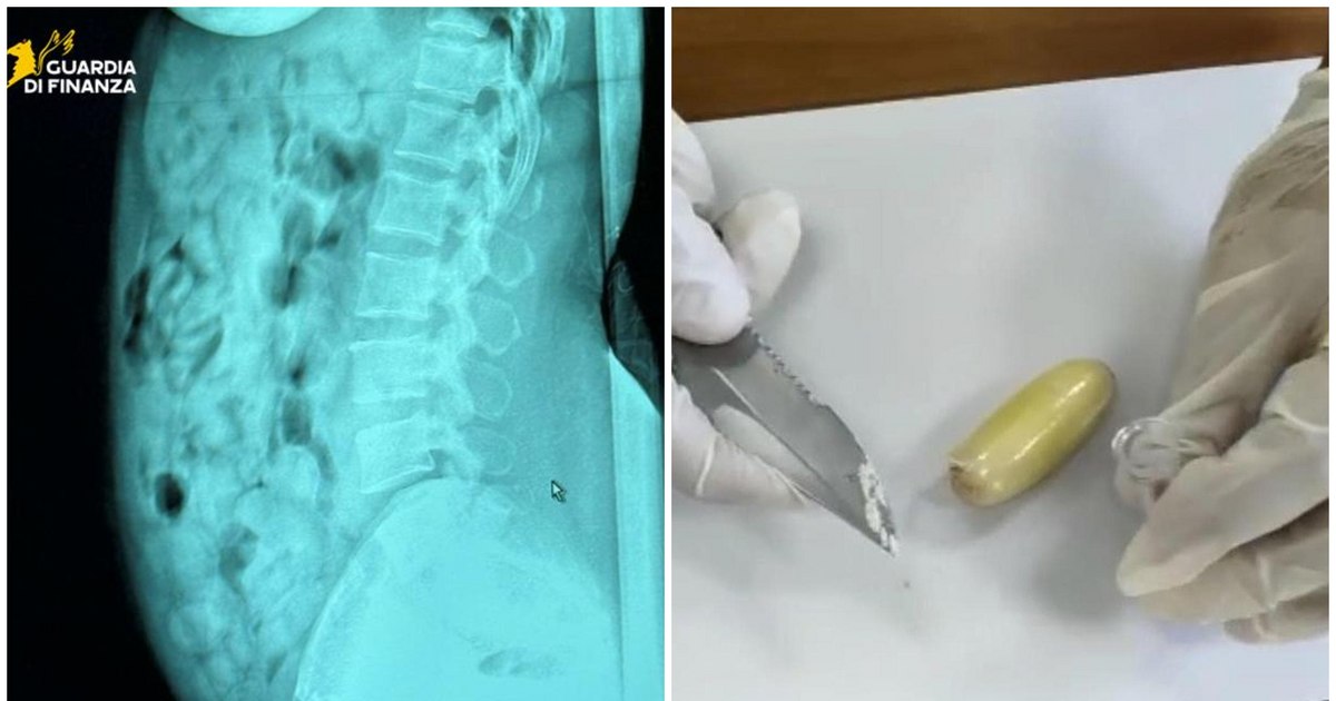 Romanian arrested on an airport in Italy, after being caught with 1.4 kg of drugs in the stomach