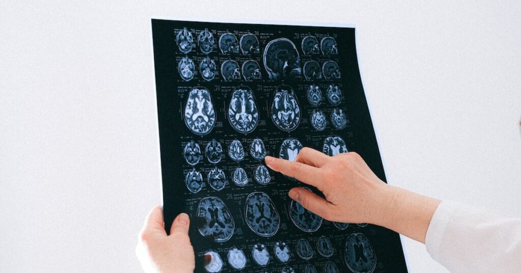 The 4 ages at which our brains change. Neural adolescence lasts up to 32 years