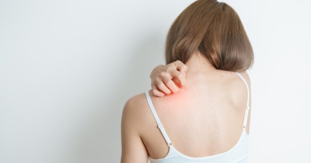 Confirmed case of leprosy in Romania. The Minister of Health announces three suspicions of Asian masseuses in Cluj-Napoca