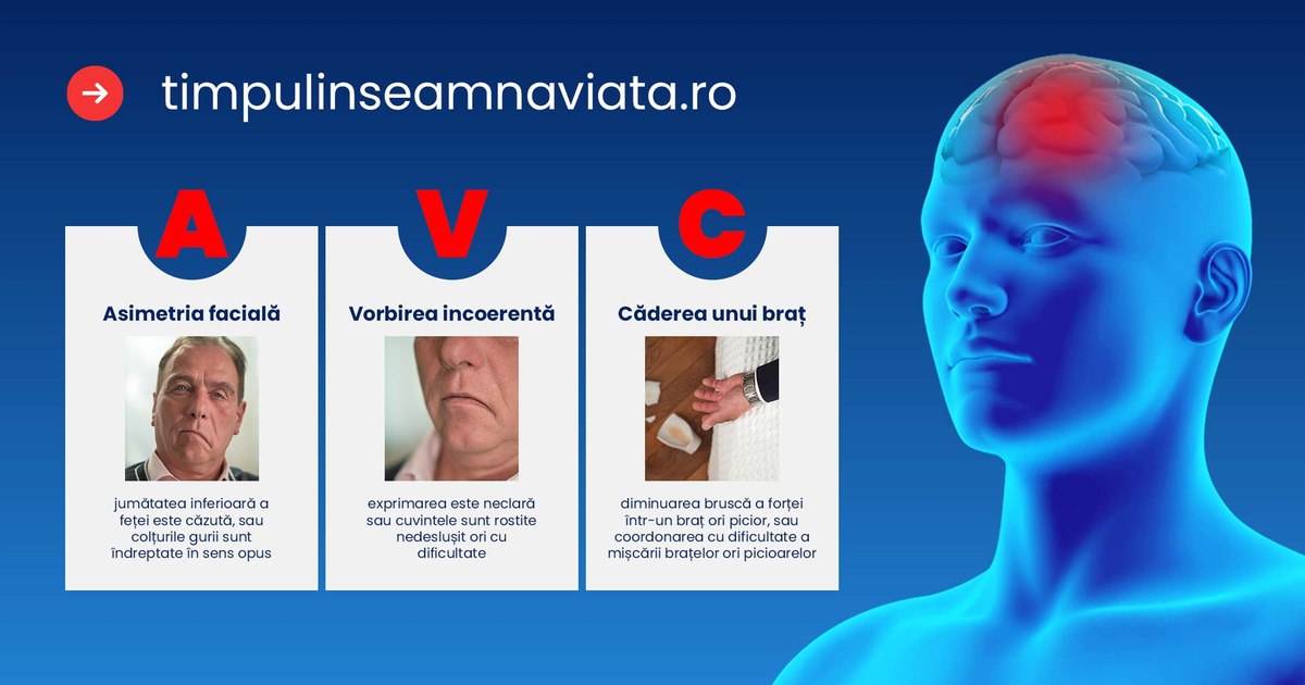 Romania and the fight against stroke: from 14 hospitals to a national rapid treatment network