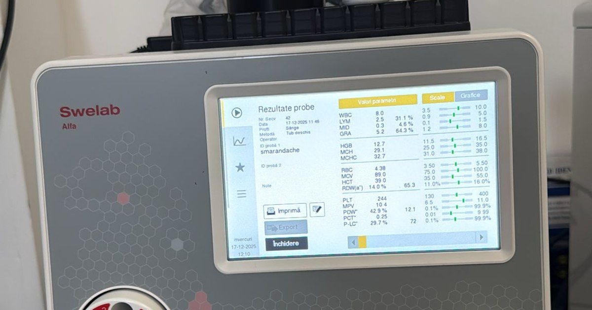 The device that saves babies from trauma. "We will harvest from the finger, as a common blood sugar is harvested"