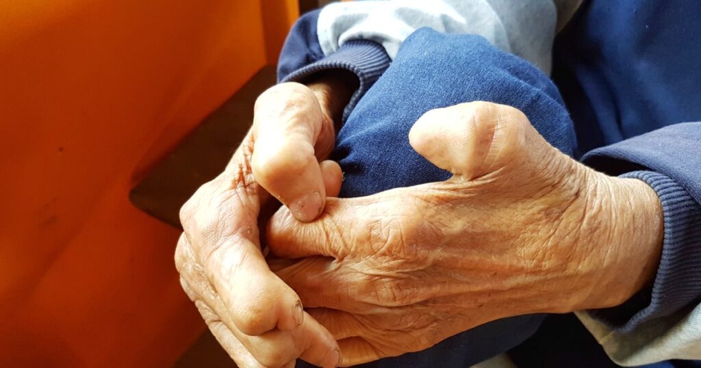 What is leprosy and how is it transmitted? The first case, confirmed in Romania after more than four decades