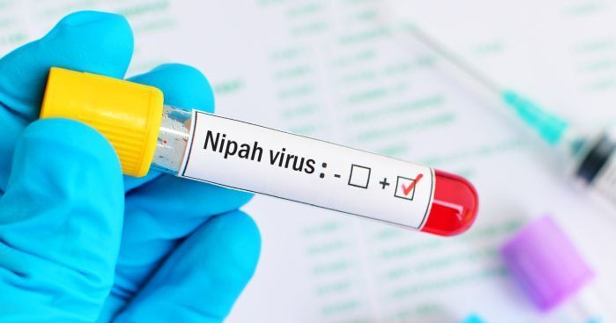 The Nipah virus comes back to the attention of the authorities after new outbreaks in India. What it is, how it is transmitted and how high the risk is