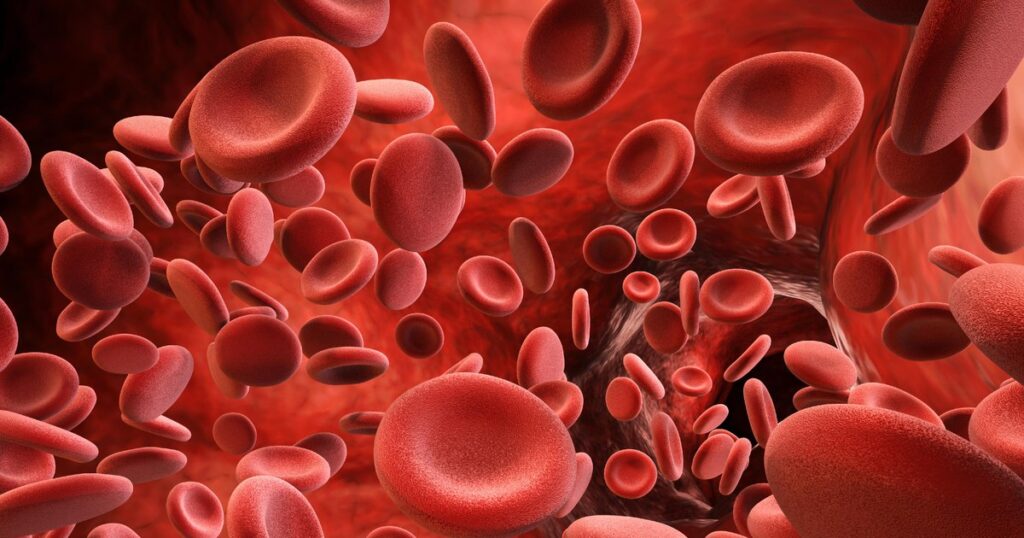 We have medicine, but we don't know who the sick are. Why the "missing link" diagnosis remains for patients with hemophilia in Romania