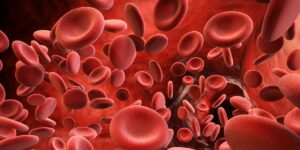 We have medicine, but we don’t know who the sick are. Why the “missing link” diagnosis remains for patients with hemophilia in Romania