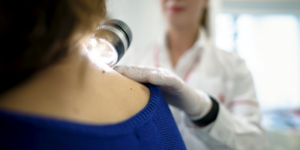 A center dedicated to the diagnosis and treatment of melanoma was opened in Bucharest