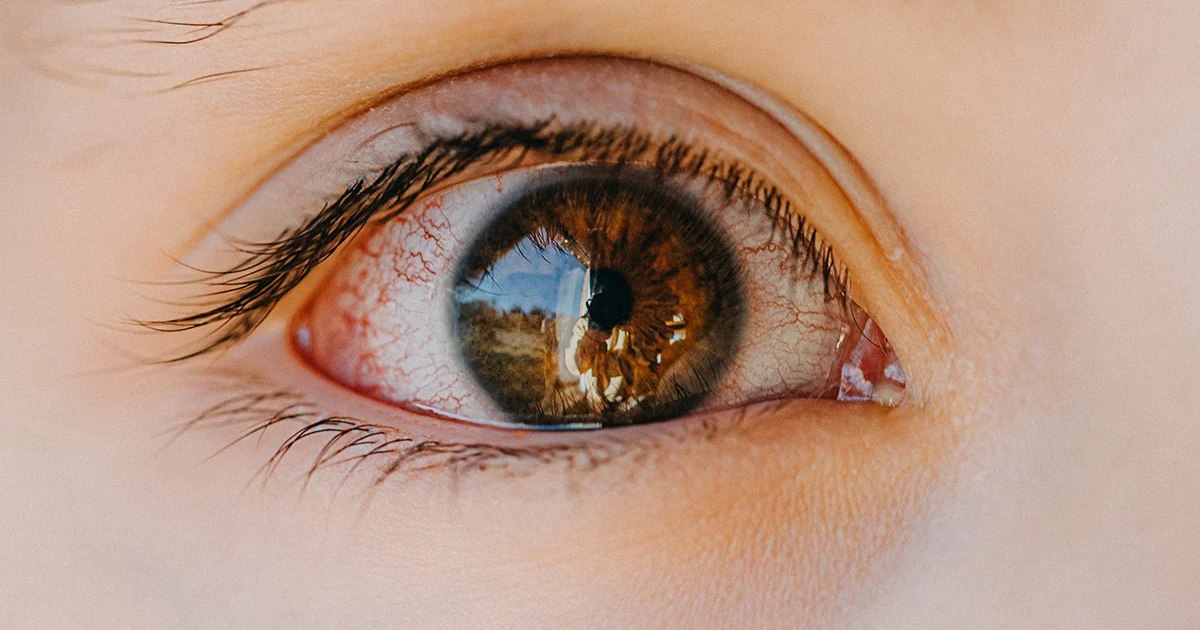The parasite hidden in meat that infects 1 in 3 people in the world: the silent risk that can lead to blindness