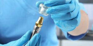 What is included in the price of a complete dental implant: From the consultation to the final control